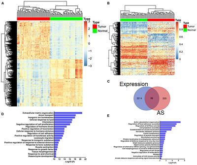 NOVA1-Mediated SORBS2 Isoform Promotes Colorectal Cancer Migration by Activating the Notch Pathway